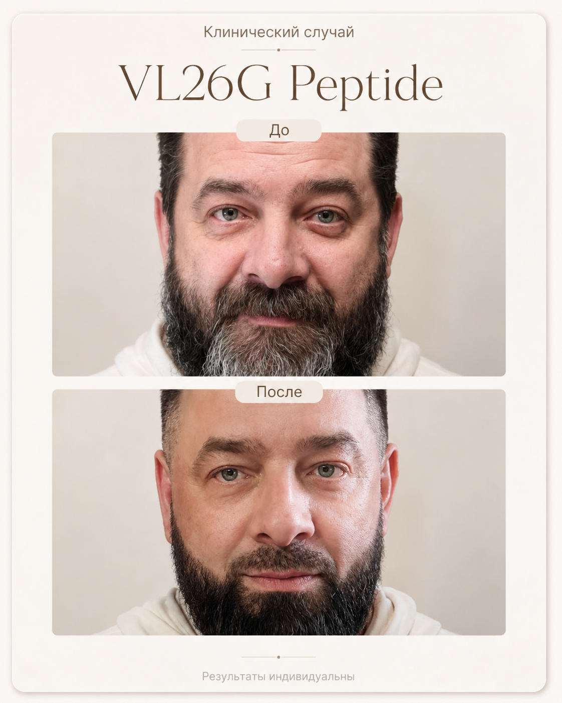 VL26G Peptide — результат после нескольких курсов